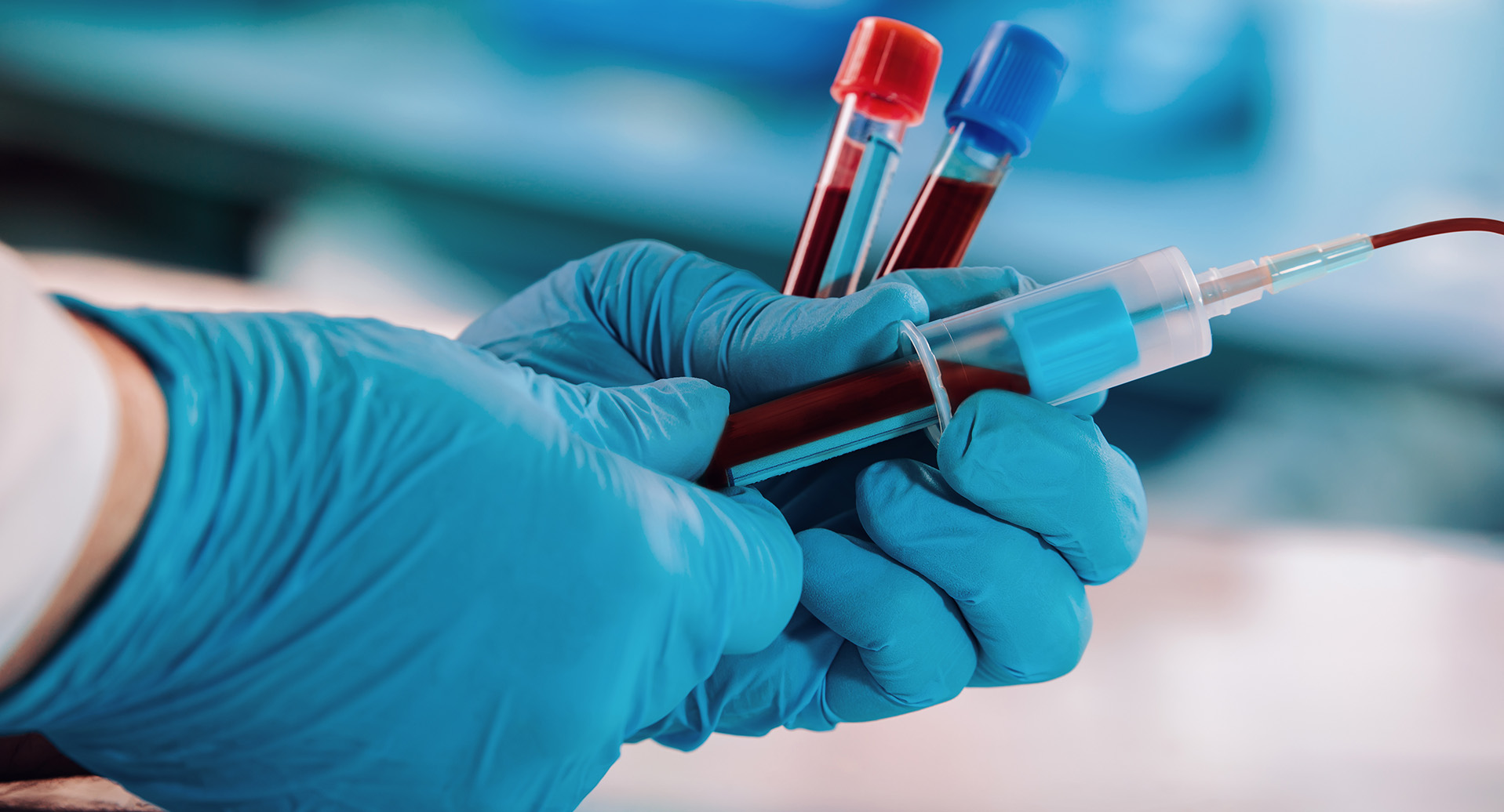 Routine Blood Collection In Central & Eastern Zones On Pause Nova